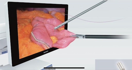 Advanced 3D laparoscopic surgery setup